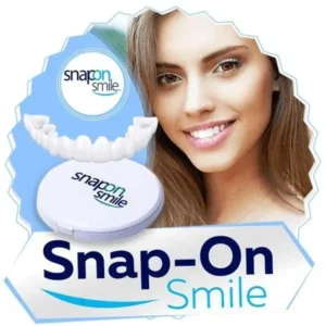 Вініри Snap-On Smile. Картинка 4.