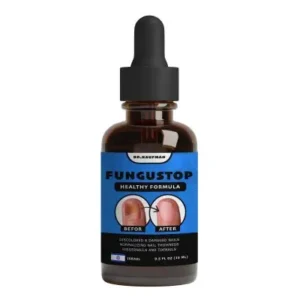 Засіб від грибка нігтів FunguStop